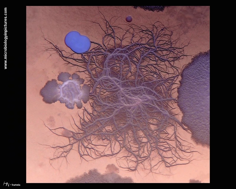 mixture of bacterial colonies